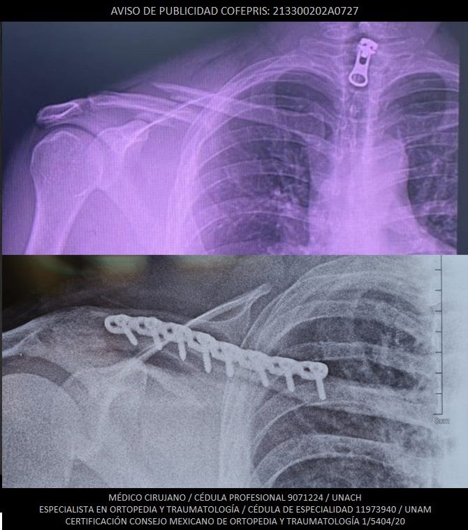 Luis Castañón Robles-16