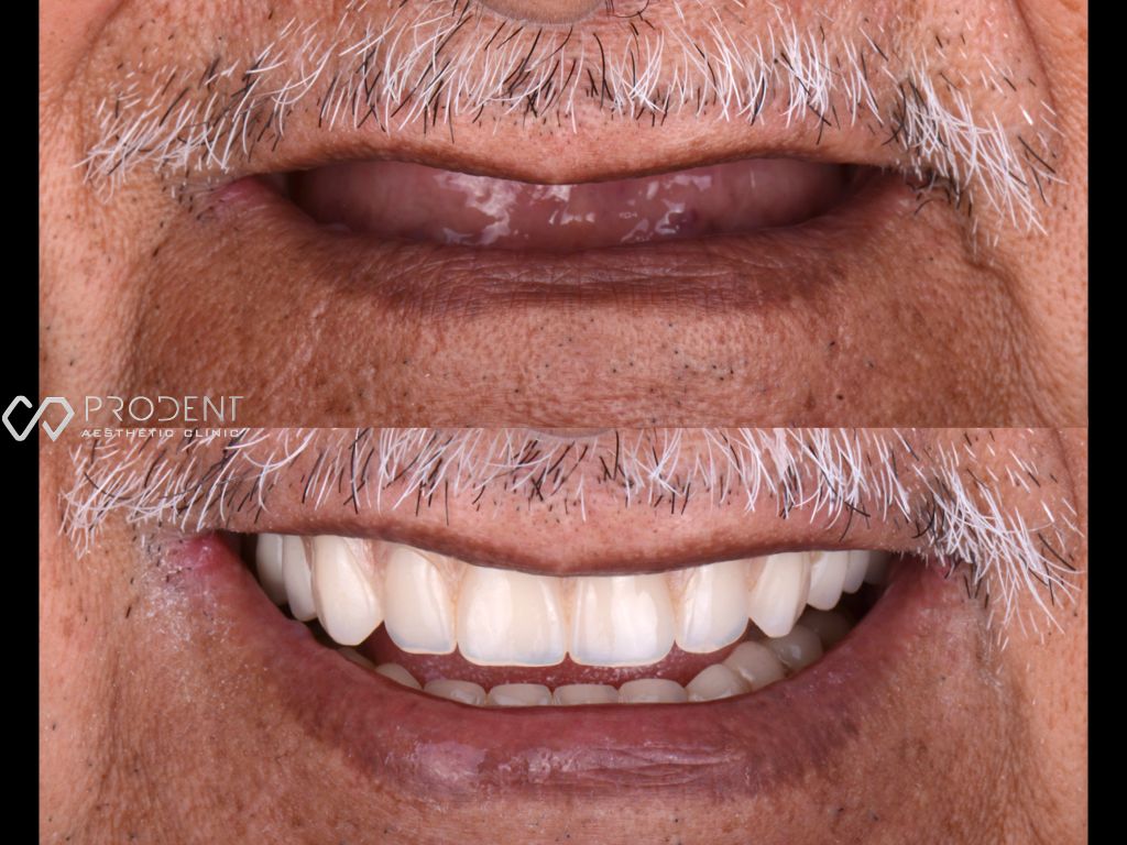 Ulises Pérez Murillo-82