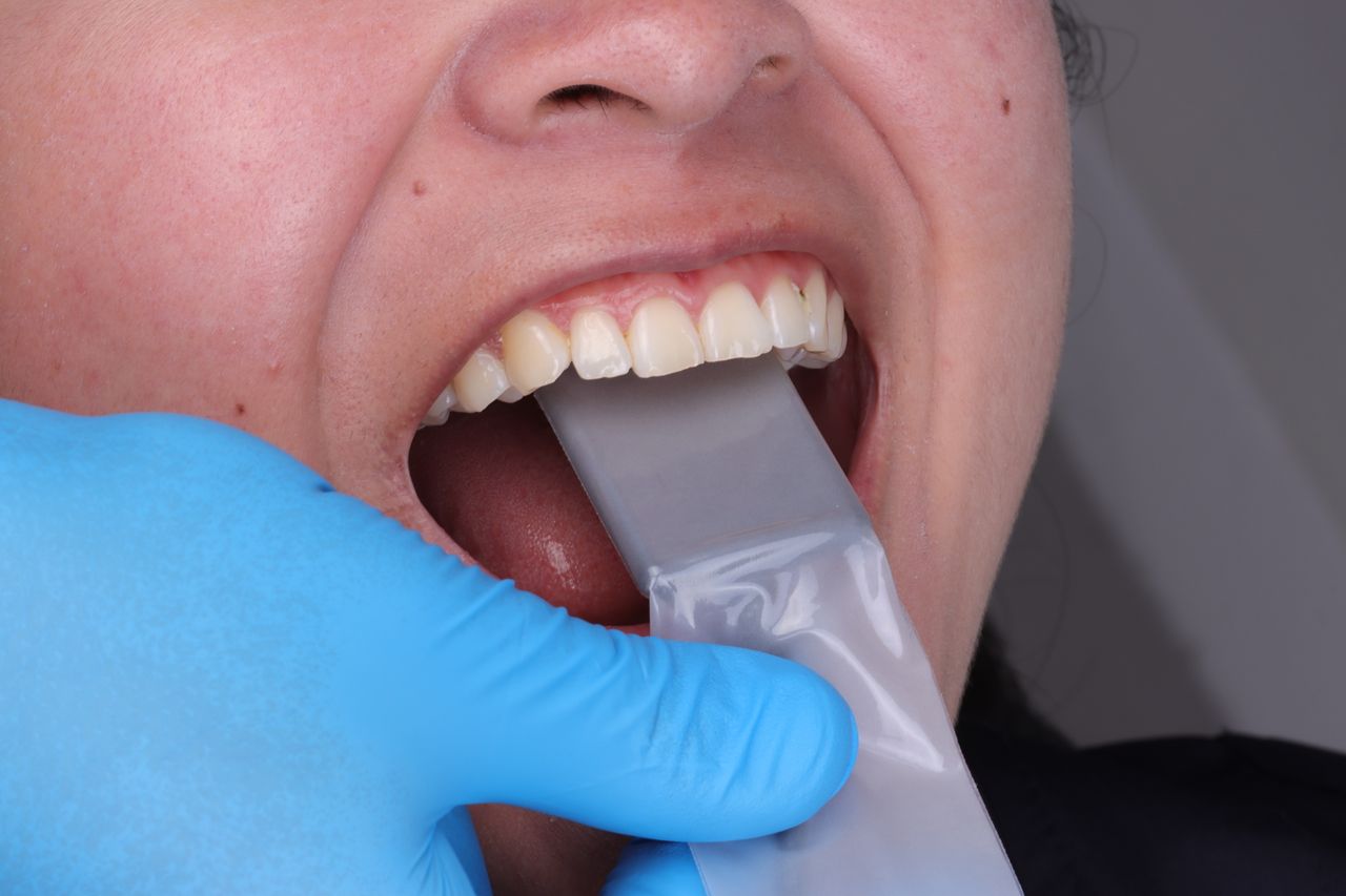 J. Ricardo Martínez-21