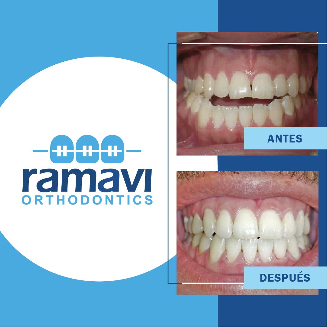 Ramon Mayorga Villeda-4