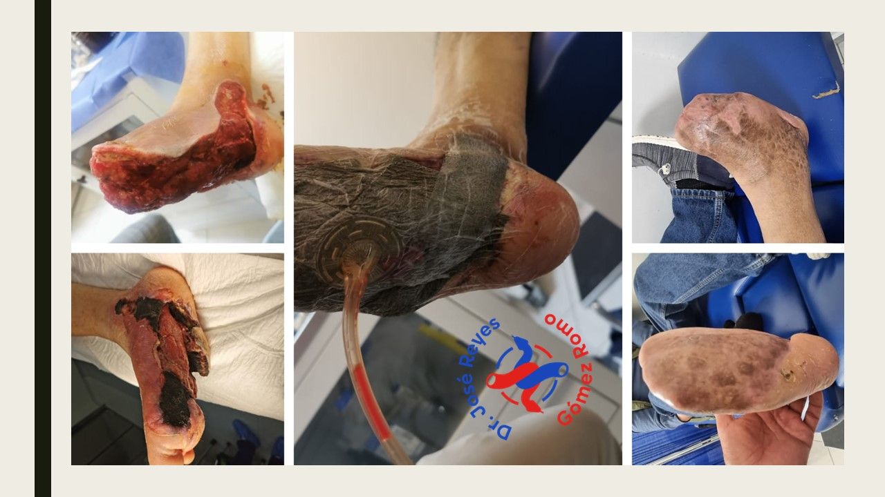 José Reyes Gómez Romo-1