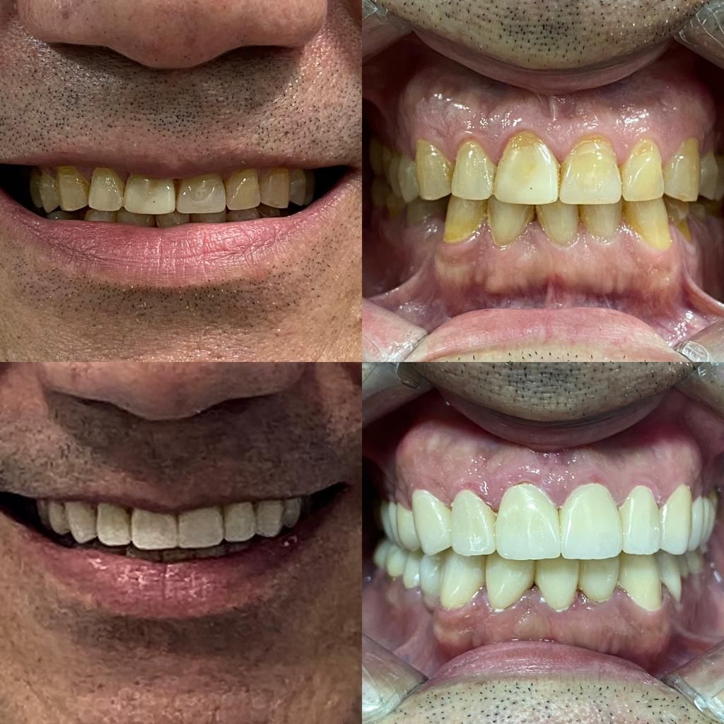 Joaquin Moguel Del Rivero-10