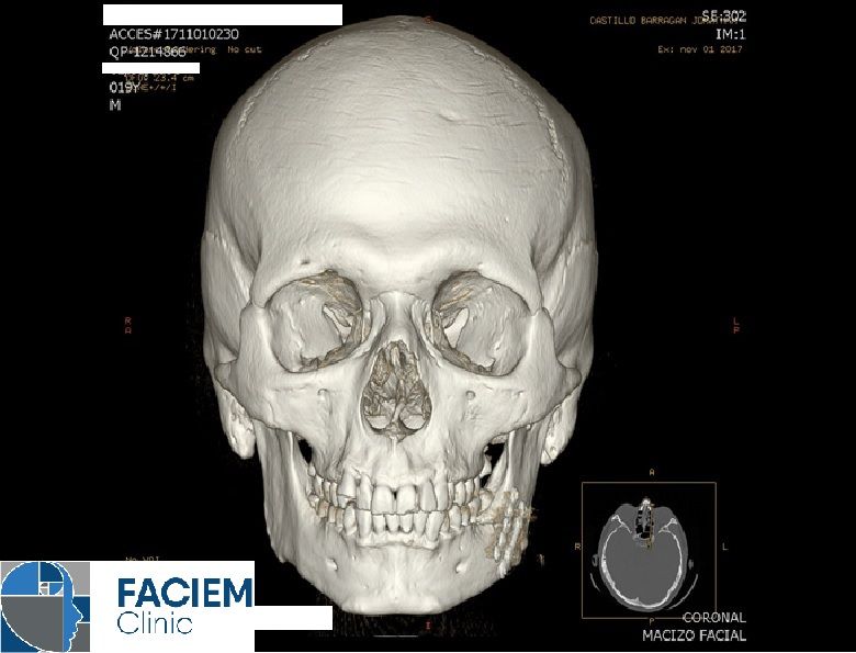 Arlen Colín Ordaz-44