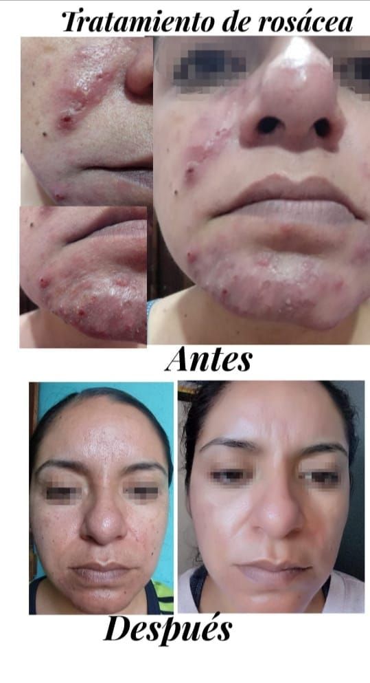 Ana Díaz Noriega-18