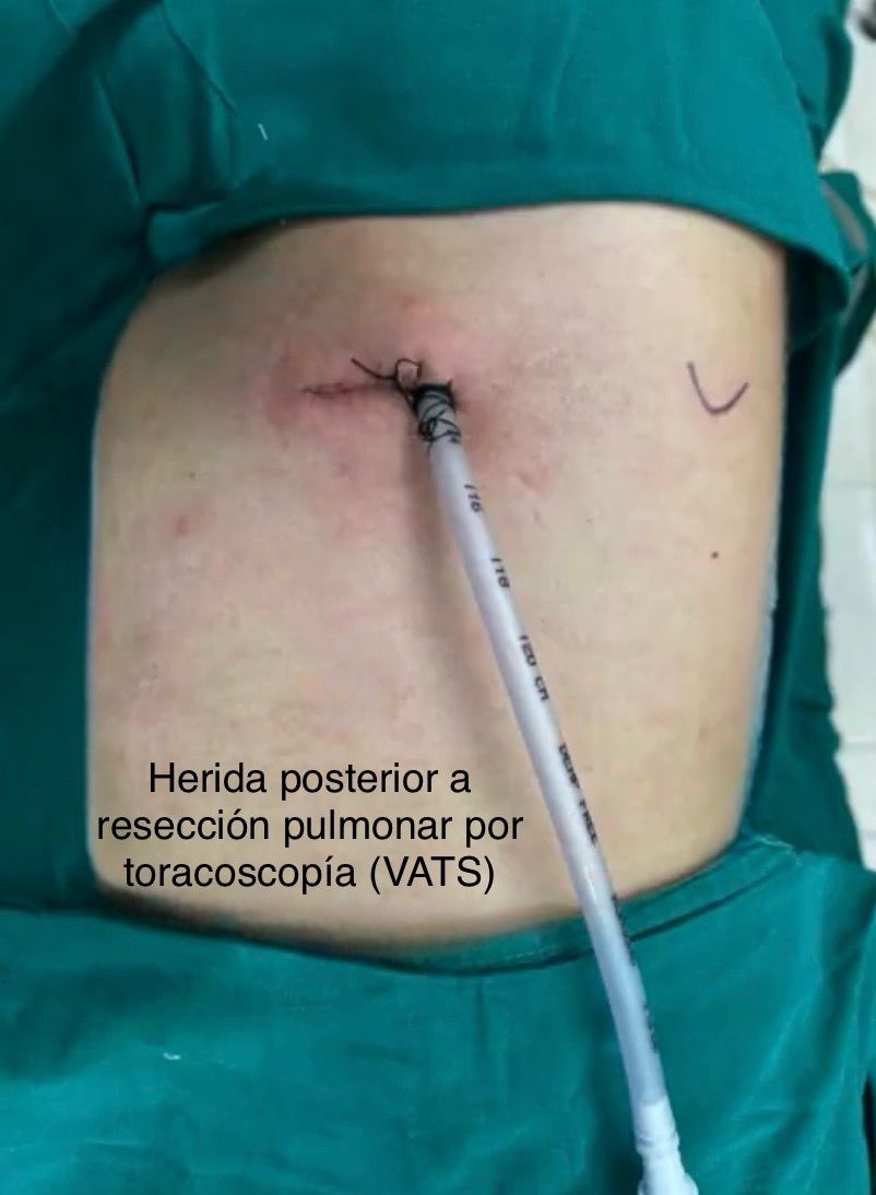 Alfredo Alejandro Paramo Lovera-6