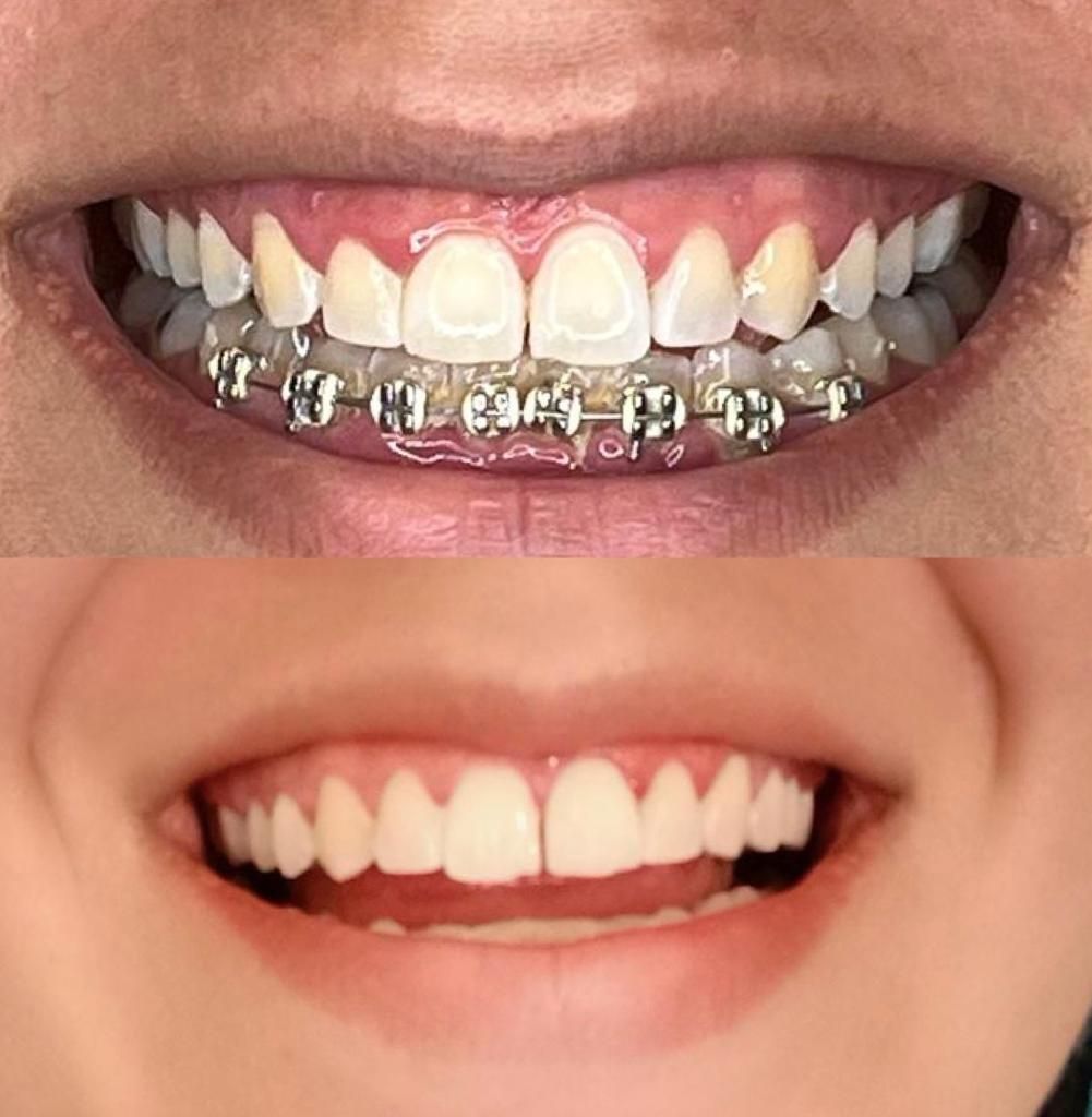 Consuelo Chapa Garza-7