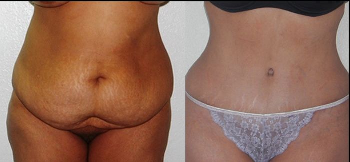 Edgar Ernesto Torres Mejía-5