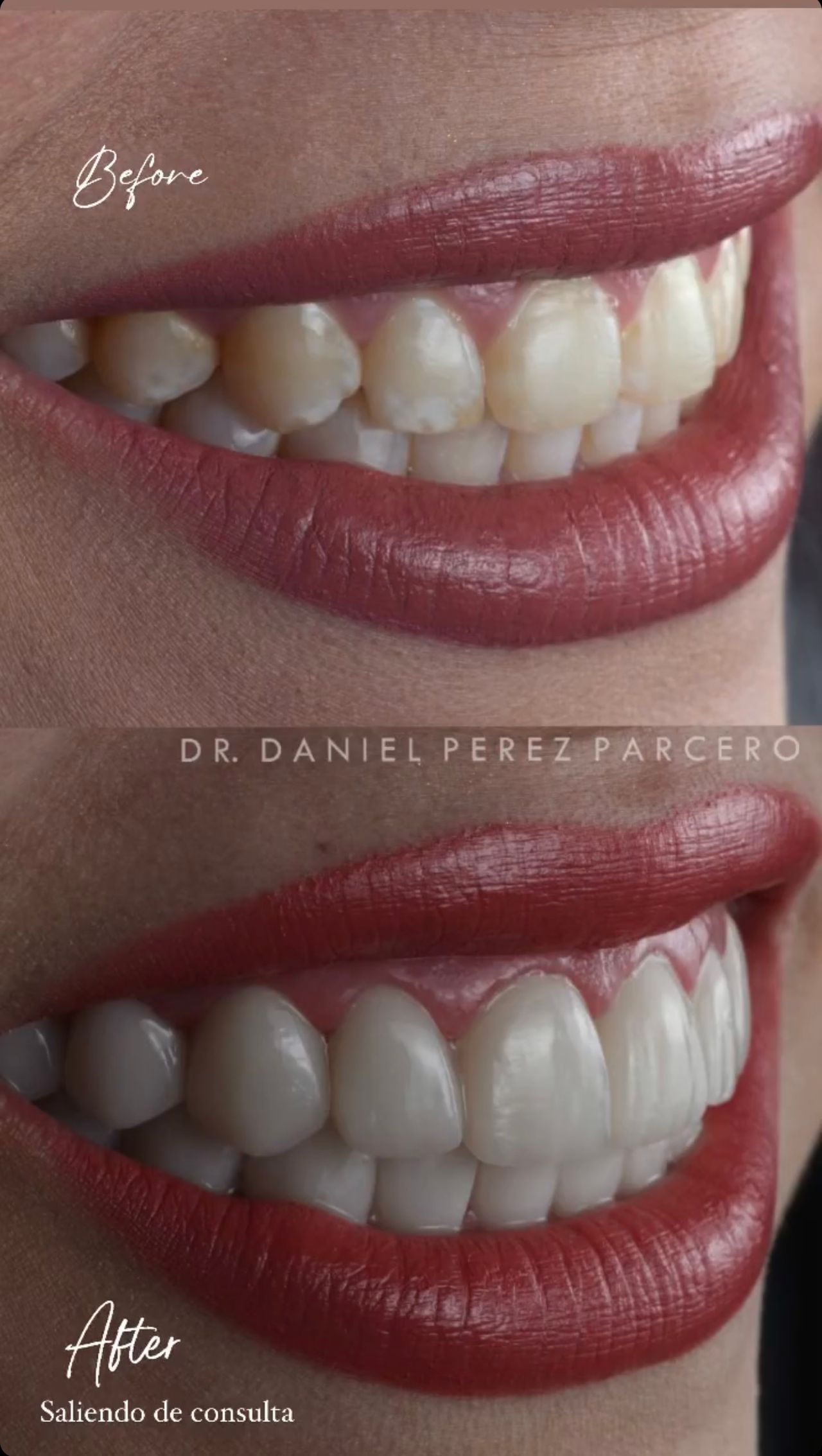 Daniel Perez Parcero-7