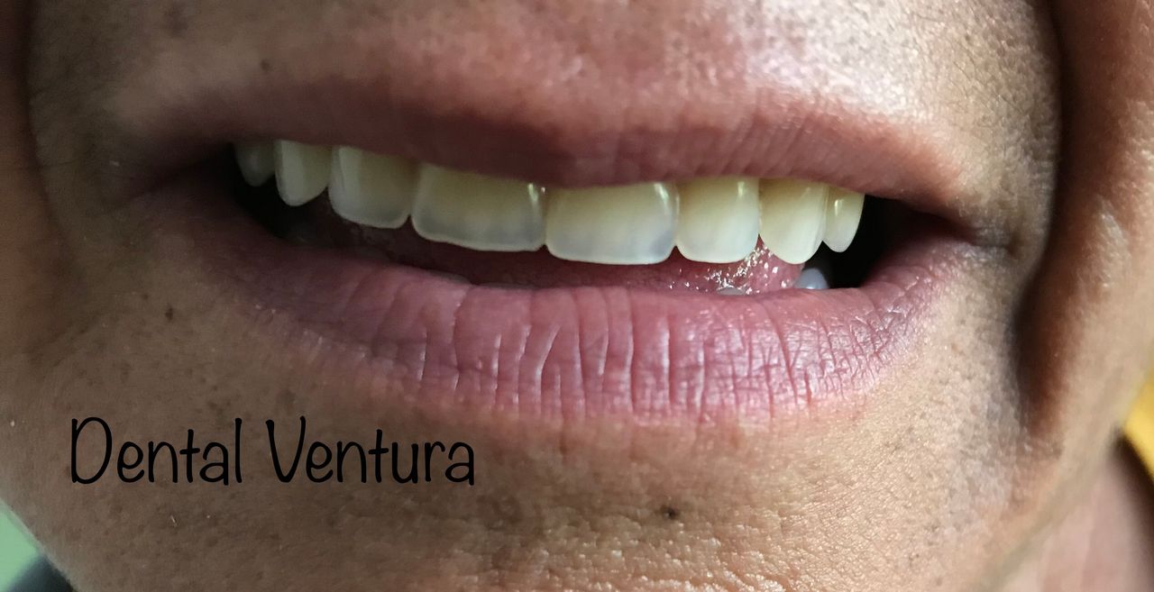 Antonio Cerda Ventura-11