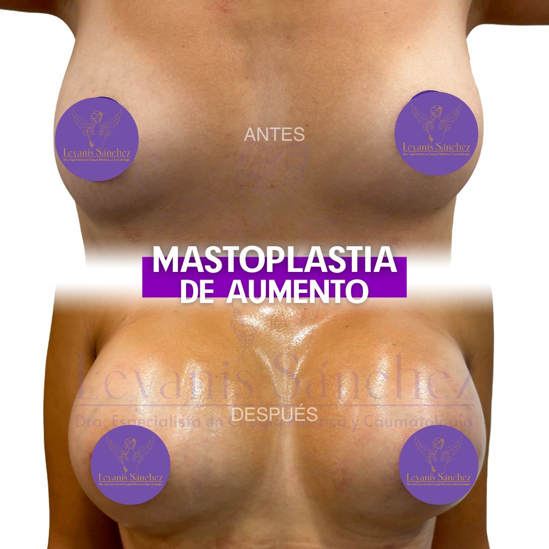 Leyanis Sánchez Hidalgo-6