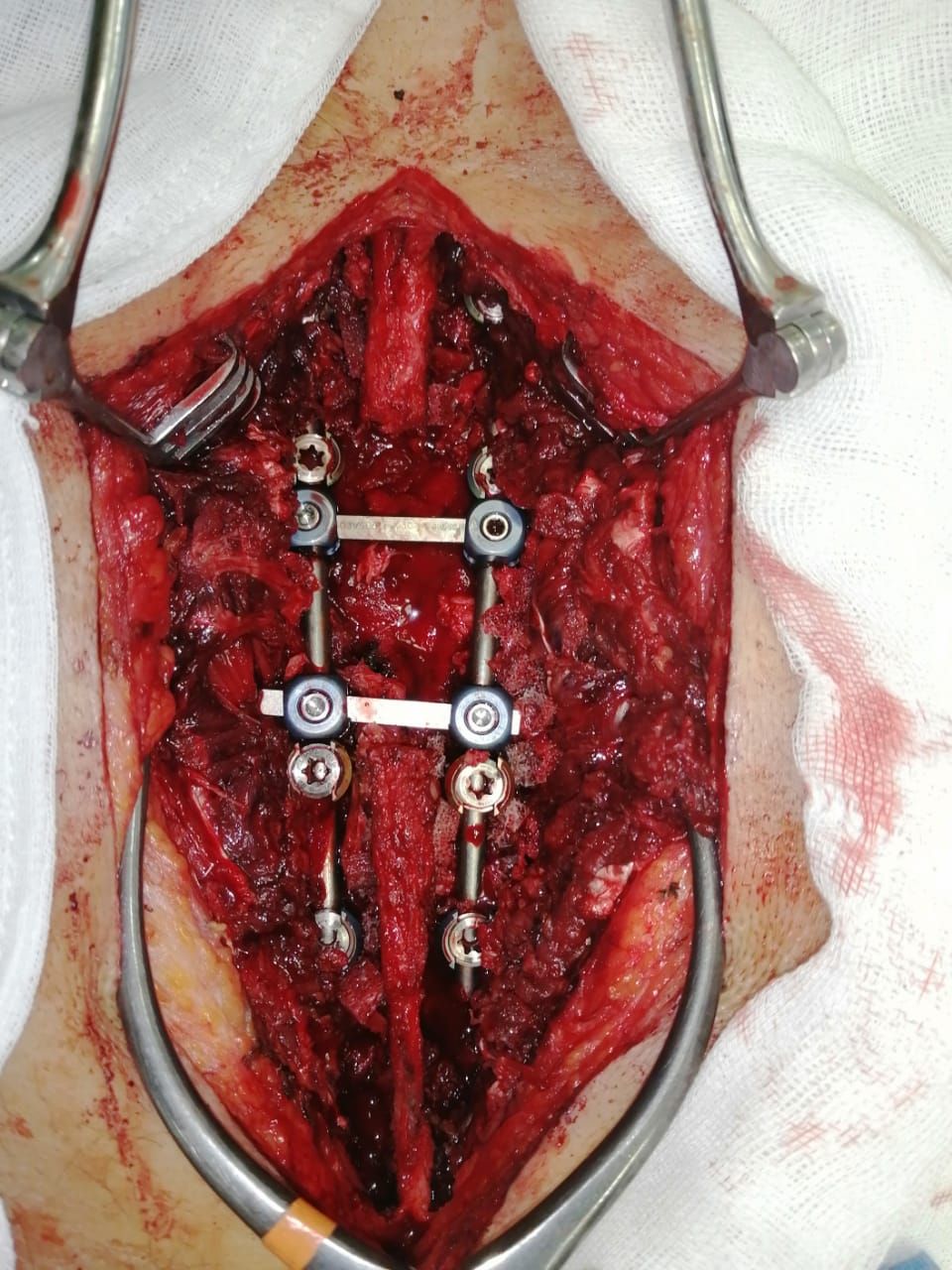 Juan José Luévano De La Cruz-27