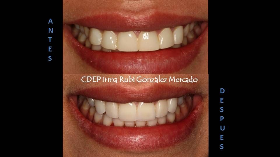 Irma Rubí González Mercado-3