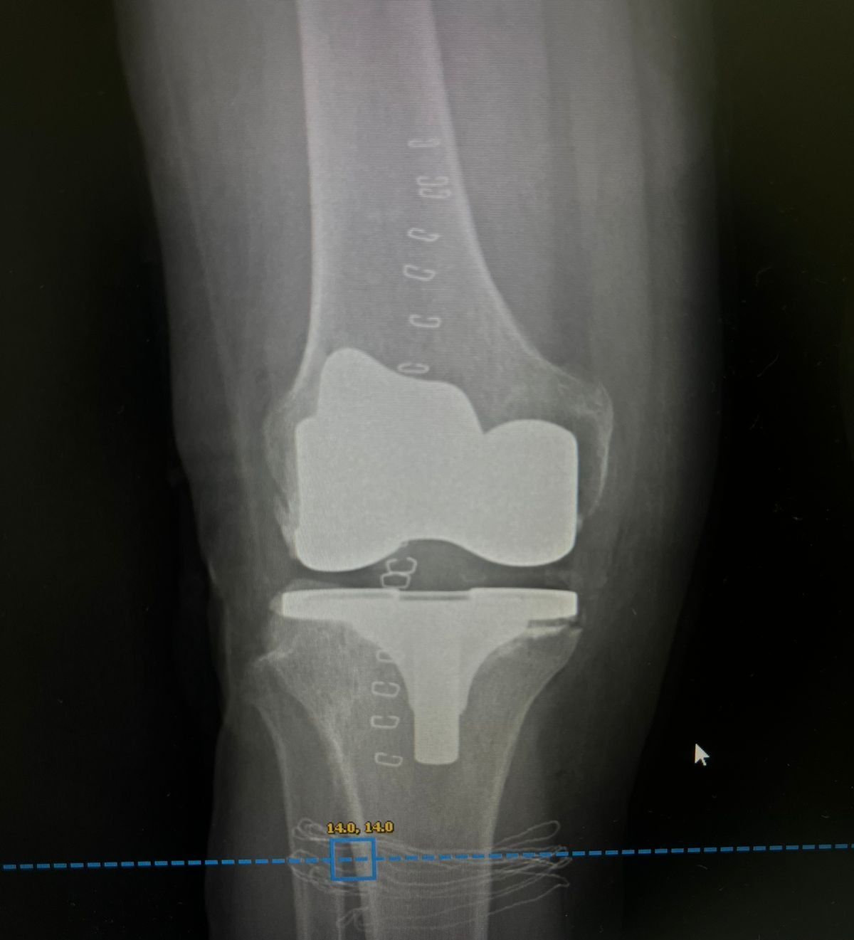 Leonardo Isaac Re-15