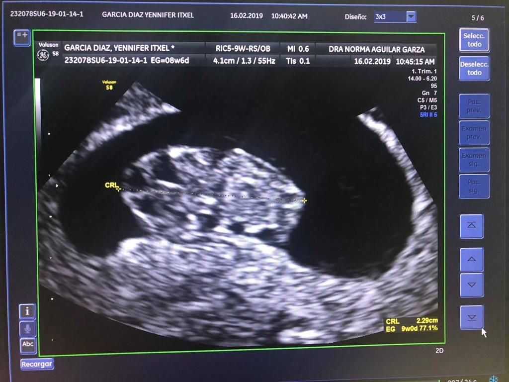 Norma Aguilar Garza-8