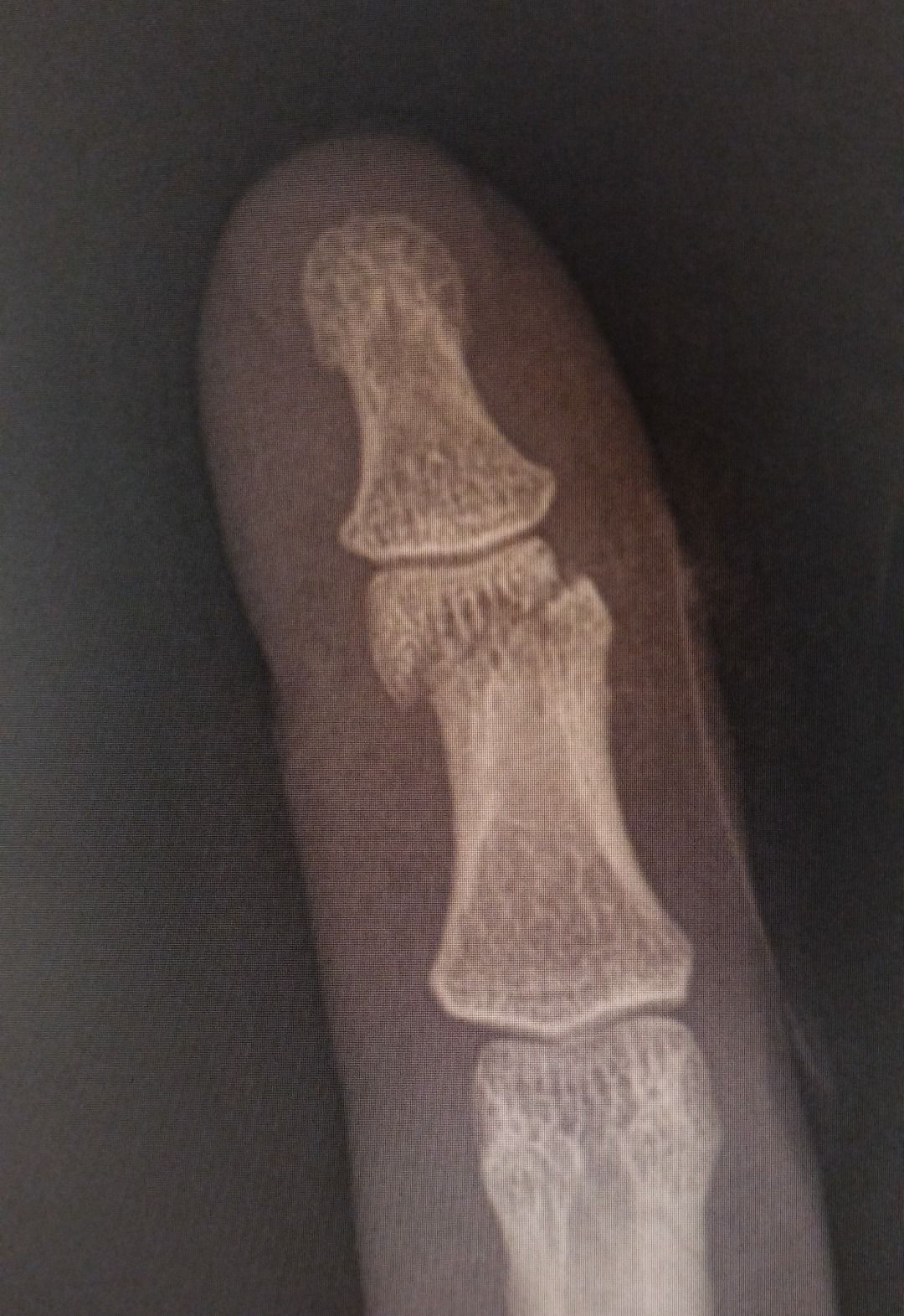 Leonardo Isaac Re-19