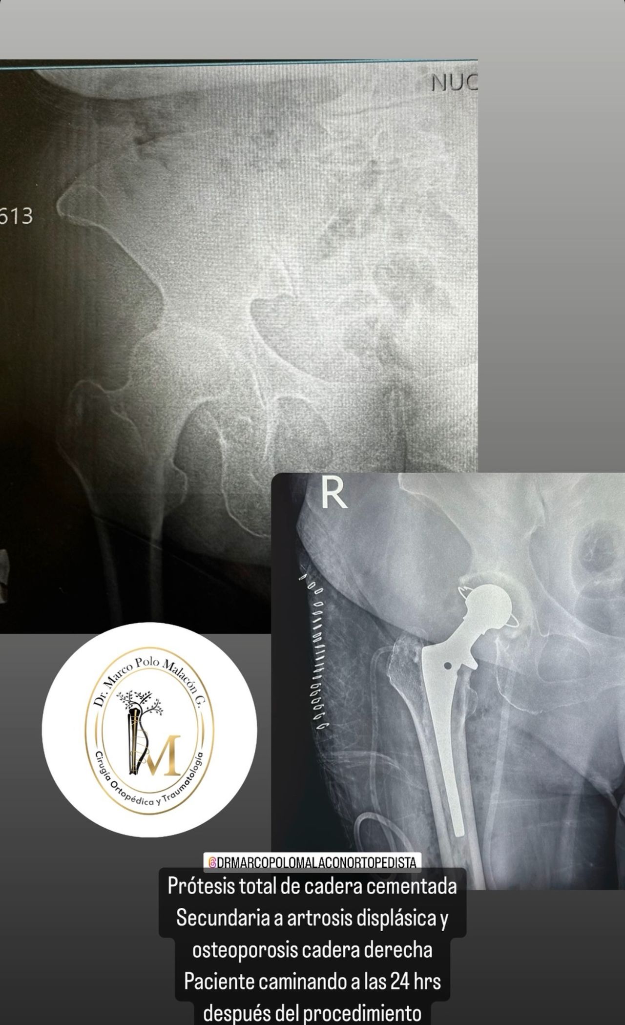 Marco Polo Malacón Gutiérrez-18