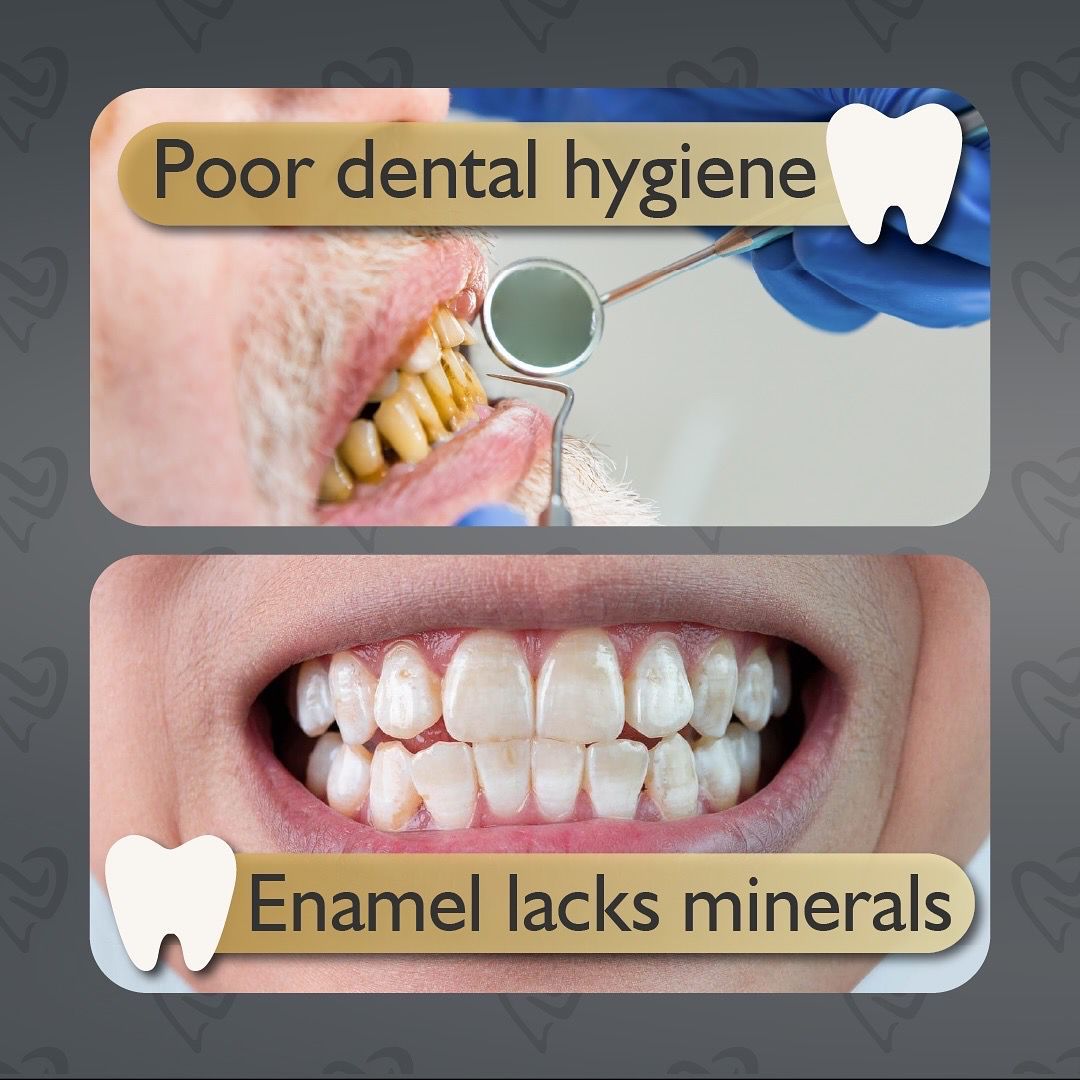 Luz Marely García Alvarez-6