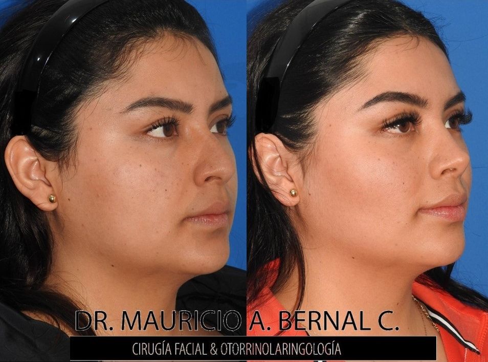 Mauricio Alejandro Bernal Carreon-21