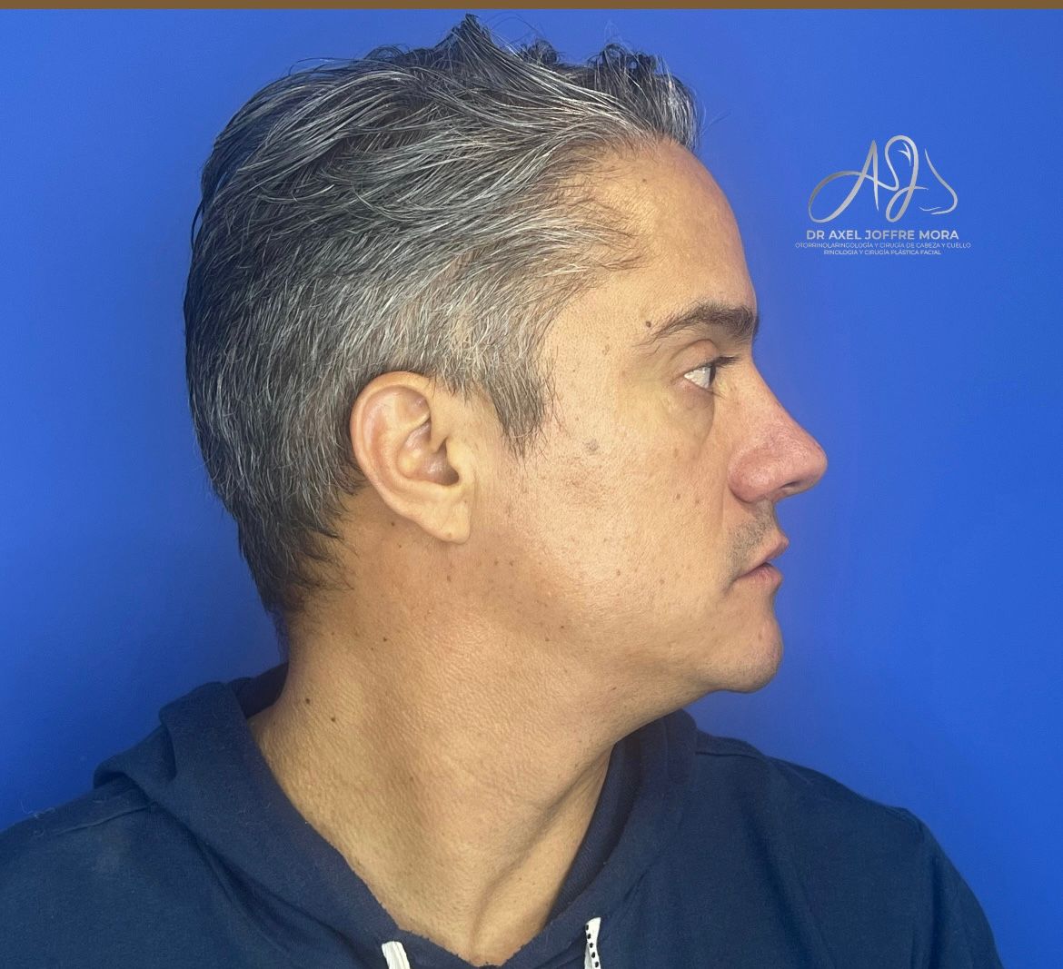 Axel Joffre Mora-7