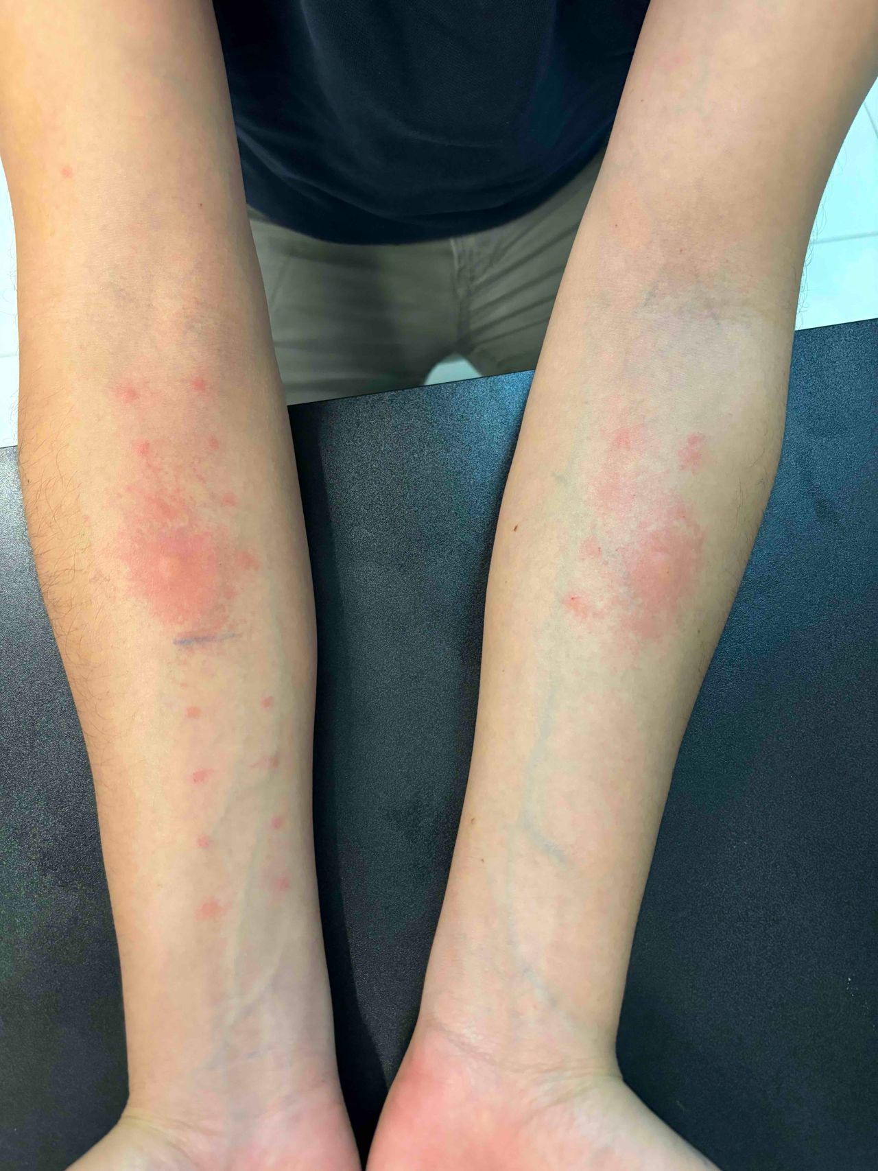 Jose Guadalupe Huerta Lopez-7