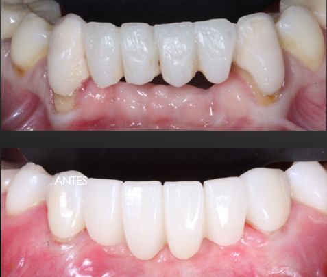 Ireri Rojas Bermúdez-24