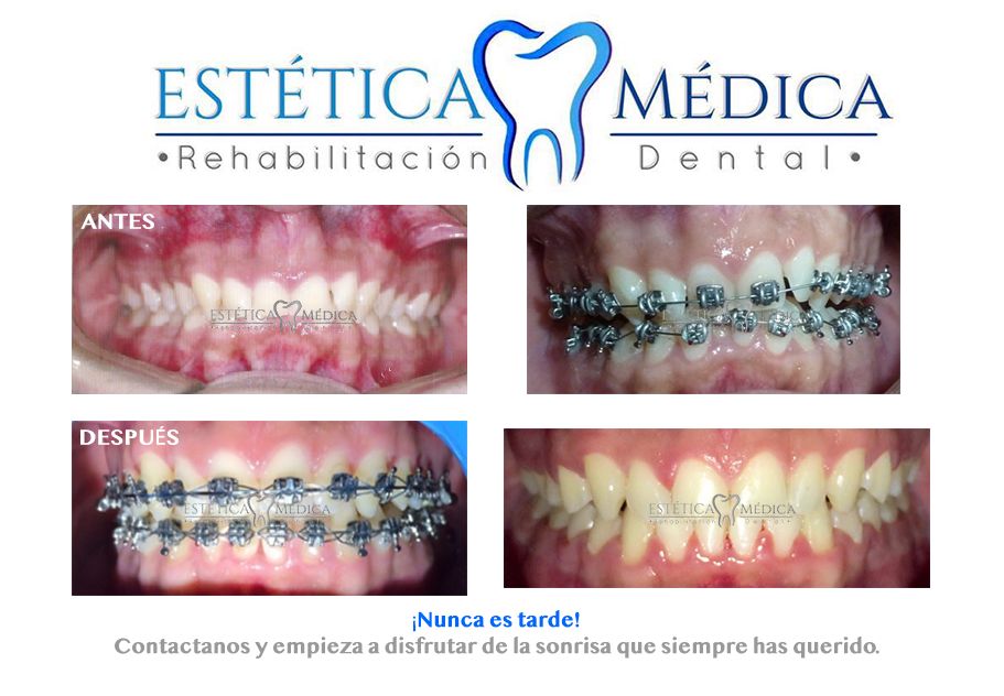 Bielmy Veronica Jonapa Peña-22