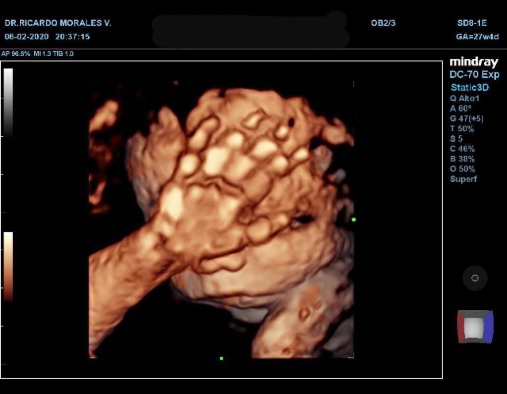 Ricardo Morales Velázquez-8