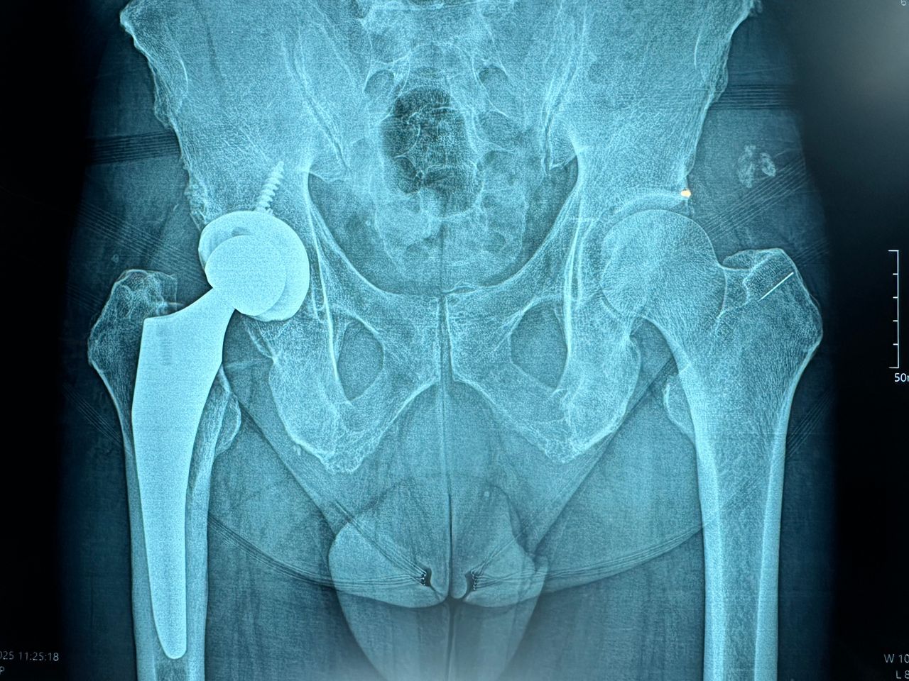 Alejandro Martínez Ramírez-44