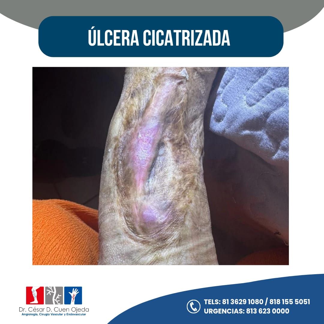 César Daniel Cuen Ojeda-2