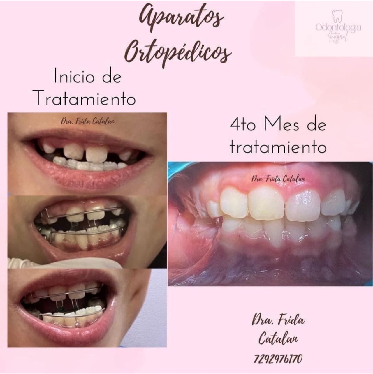 Frida Catalan Verdi-5