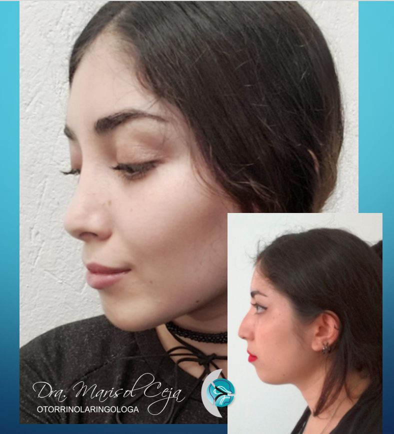 Marisol Ceja Zepeda-5