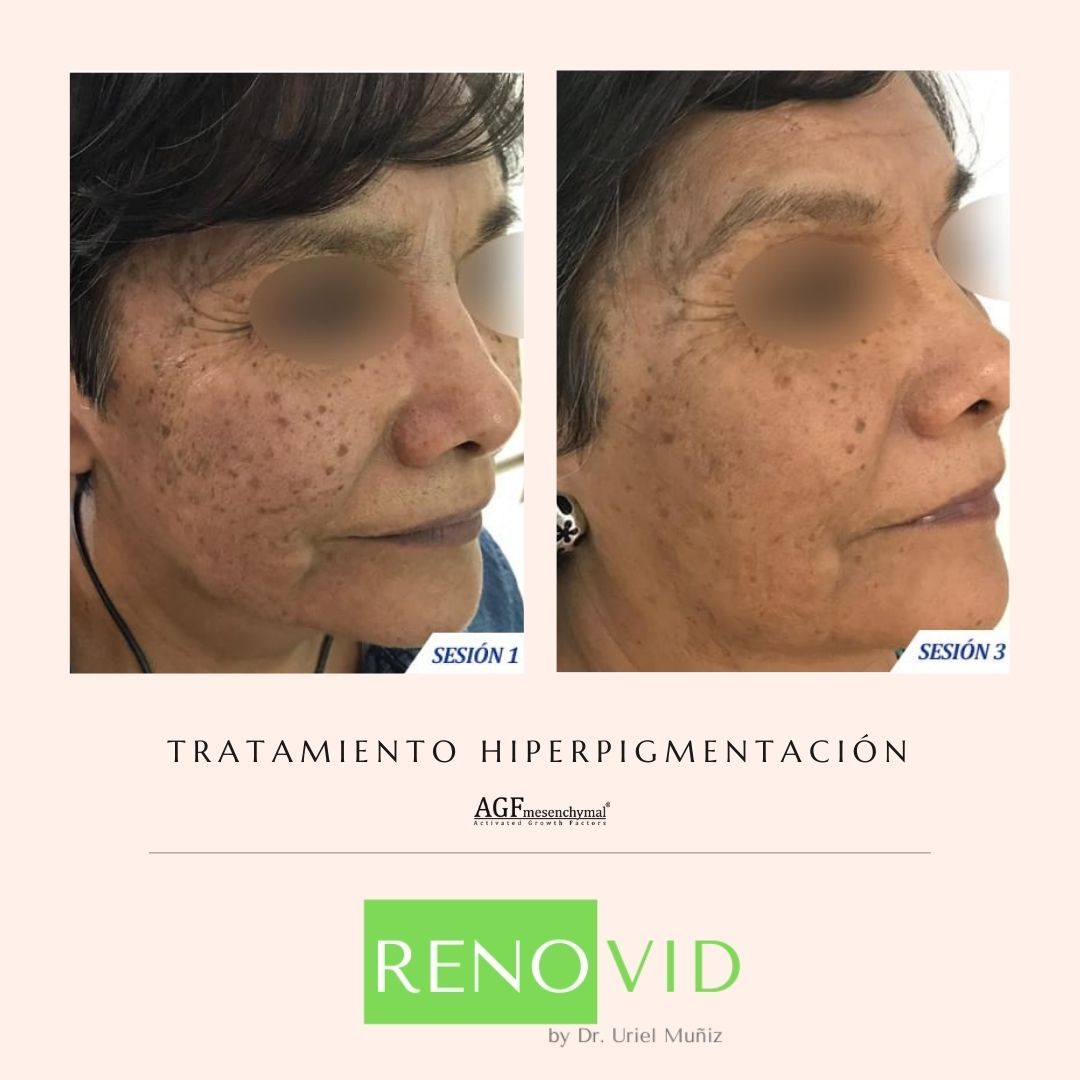 Teófilo Uriel Muñiz Chávez-53