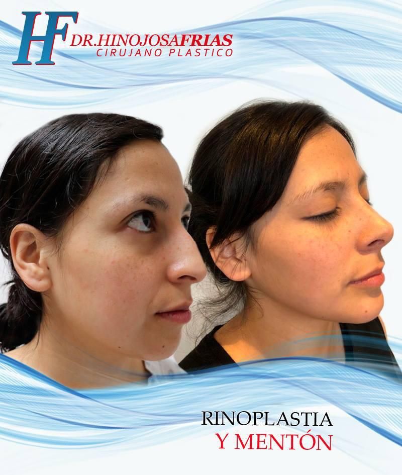 Miguel Ángel Hinojosa Frías-14