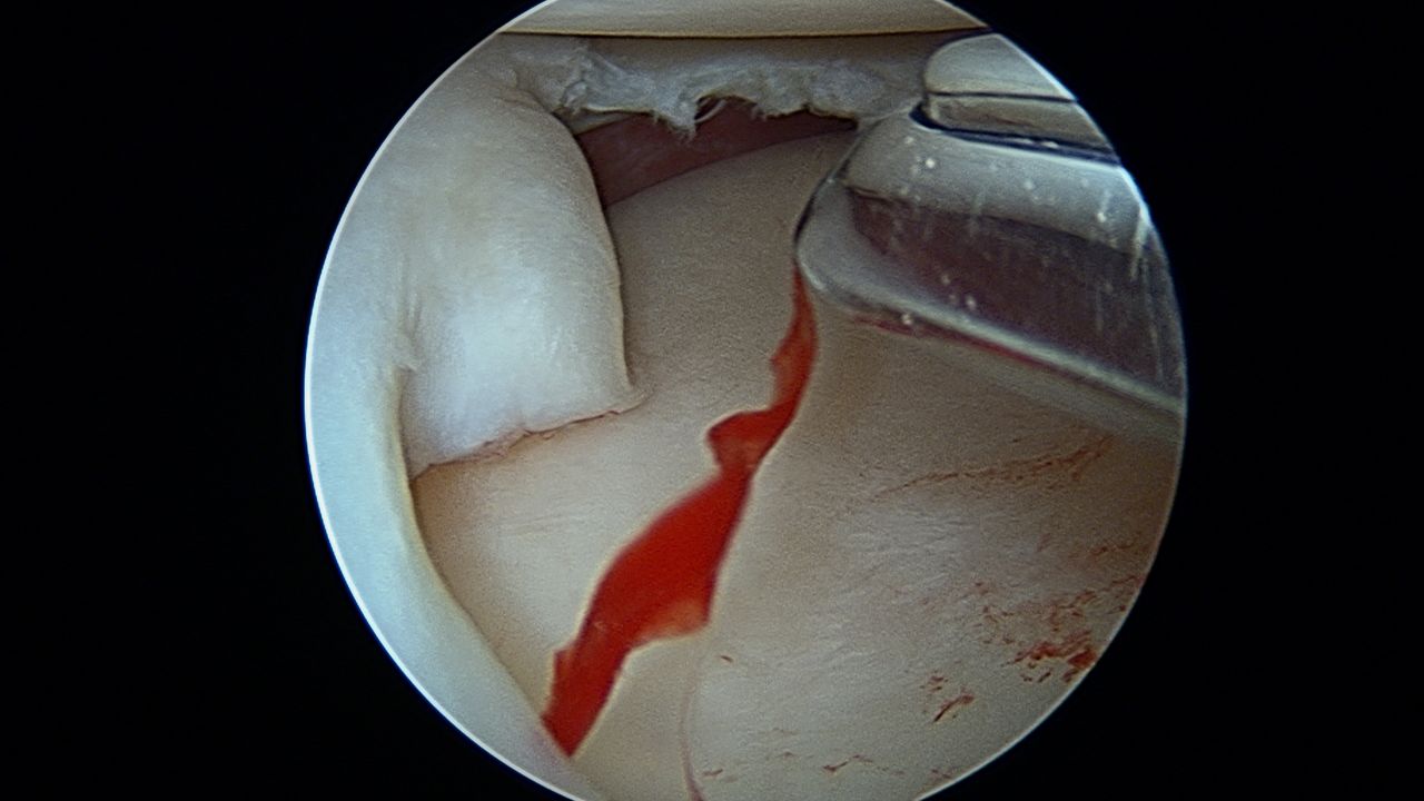 José Antonio Algarín Reyes-40