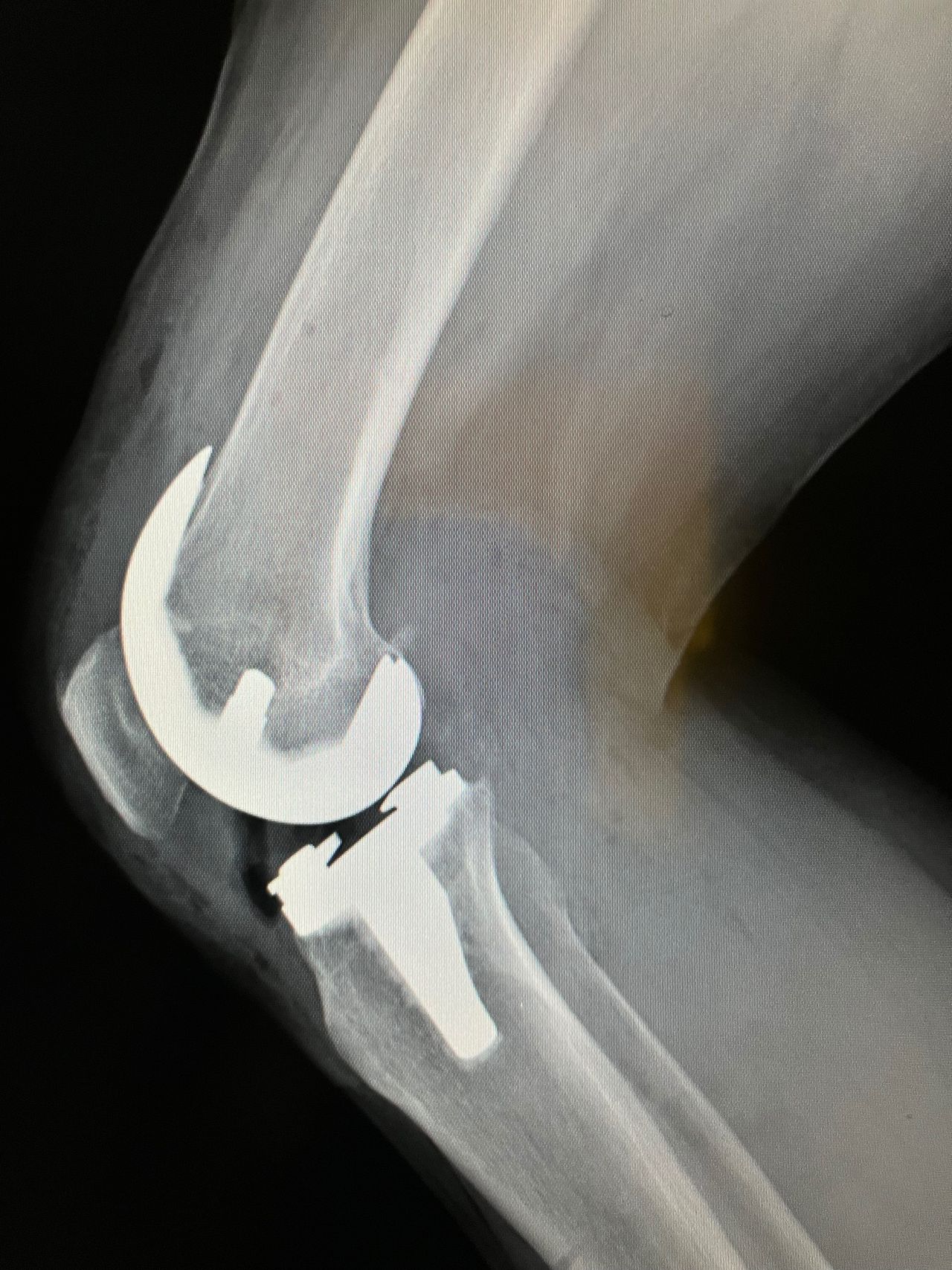 Alejandra Fuentes Martínez-22