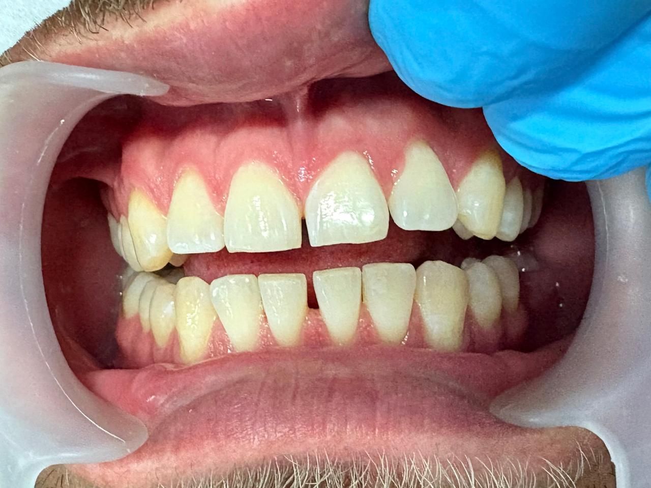 Arturo Romero Grande-36