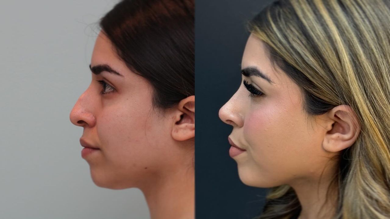 Angel Castro Urquizo-148