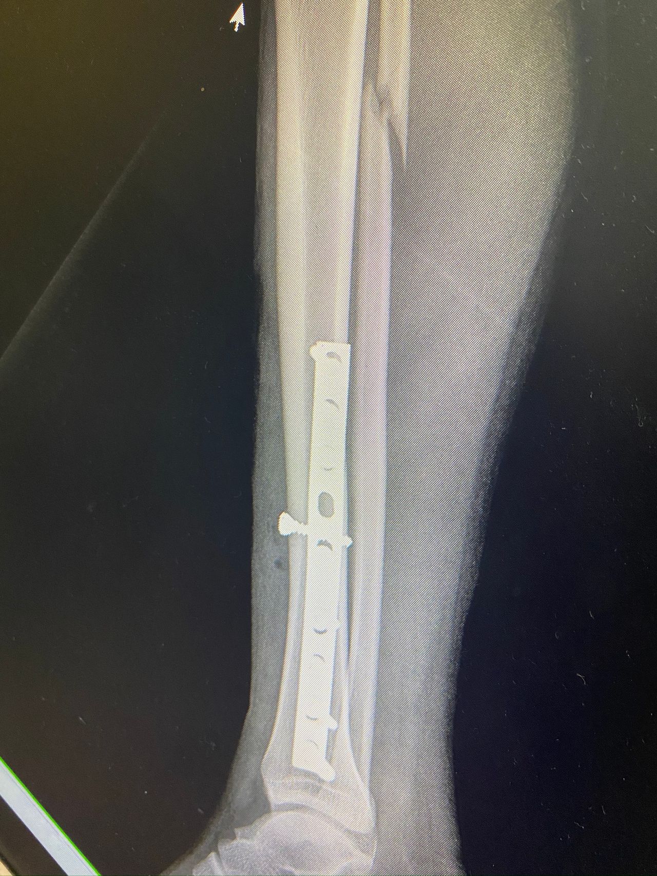 Alberto Lorenzo Cortés-15