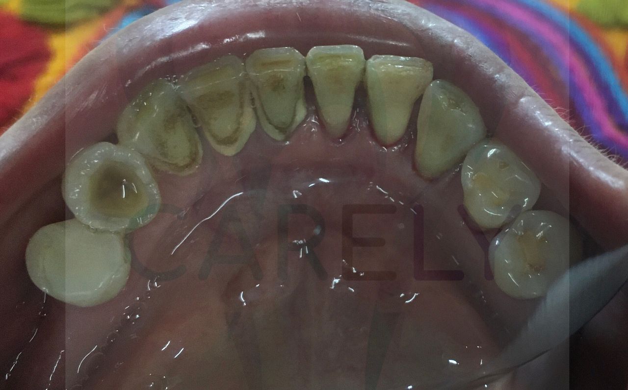 Carlos Candelaria Margarito-6