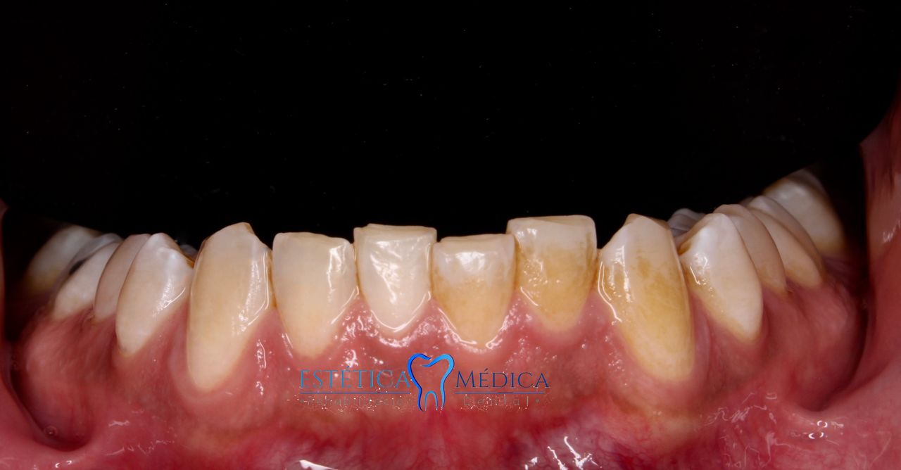 Bielmy Veronica Jonapa Peña-29