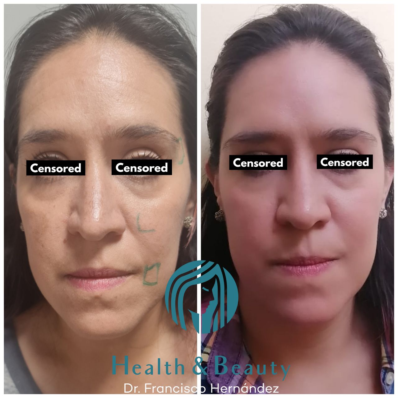 Francisco Hernández Gómez Crespo-86