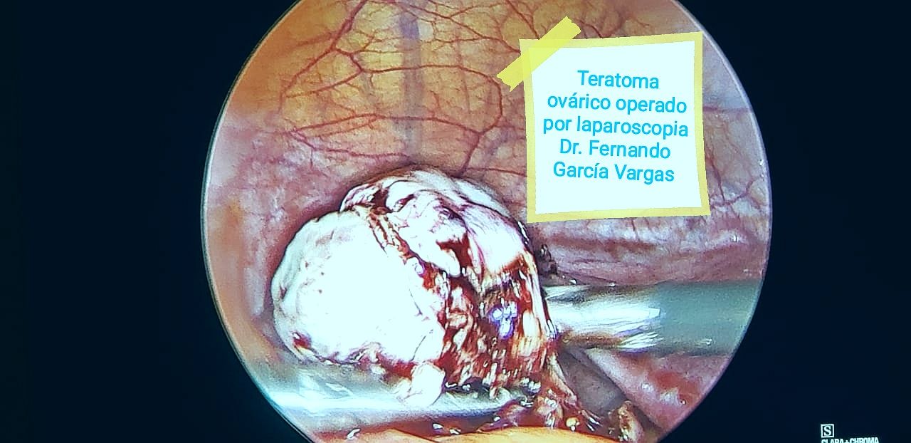 Fernando Garcia Vargas-4