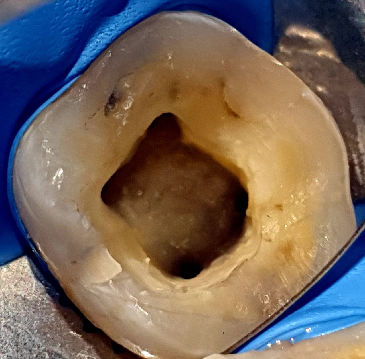 Juan Angel Cruz Rodríguez-13