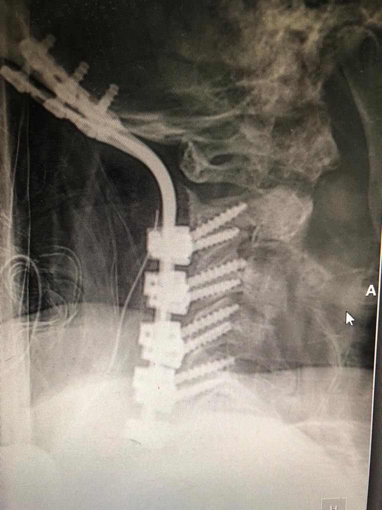 Simón Almanza Mendoza-5