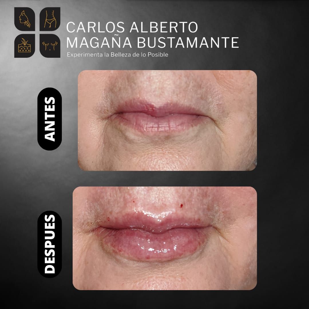 Carlos Alberto Magaña Bustamante-56