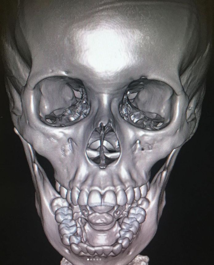 Guillermo García Garduño-22