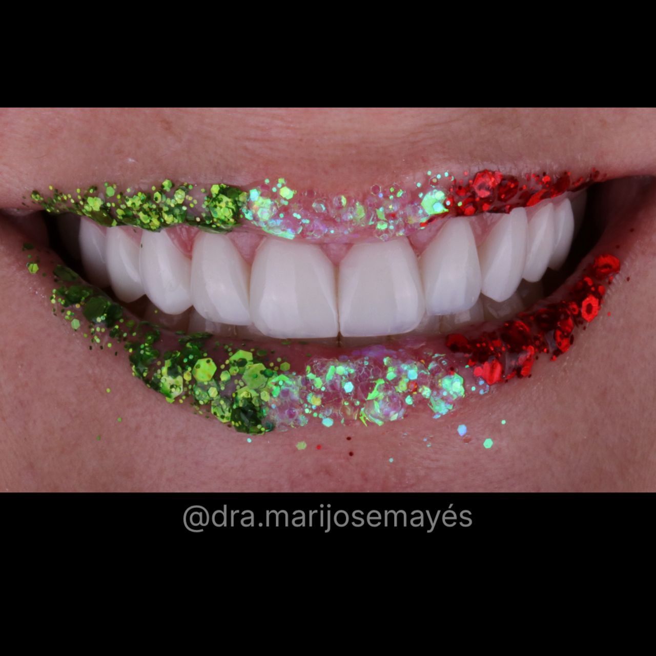 Marijose Mayes Merelles-5