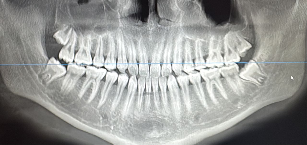 Miguel Angel Garita Cruz-11
