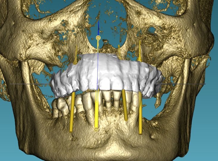 Alam Azael Arrazola González-20