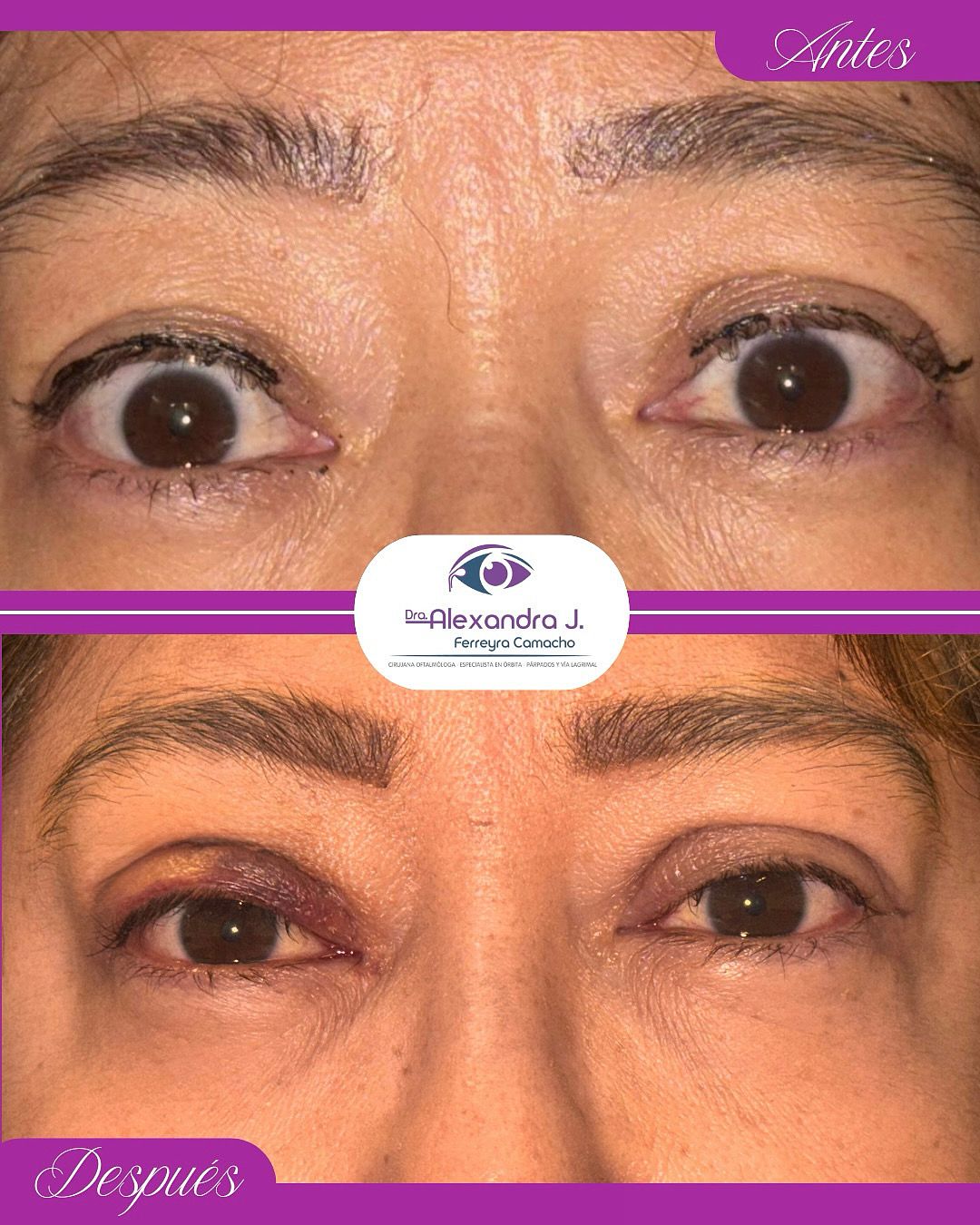 Alexandra Jocelyn Ferreyra Camacho-3